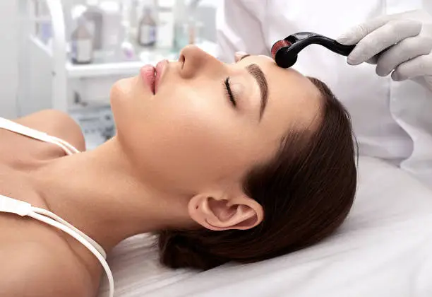A Woman is Taking Microneedling Treatment in Pune_