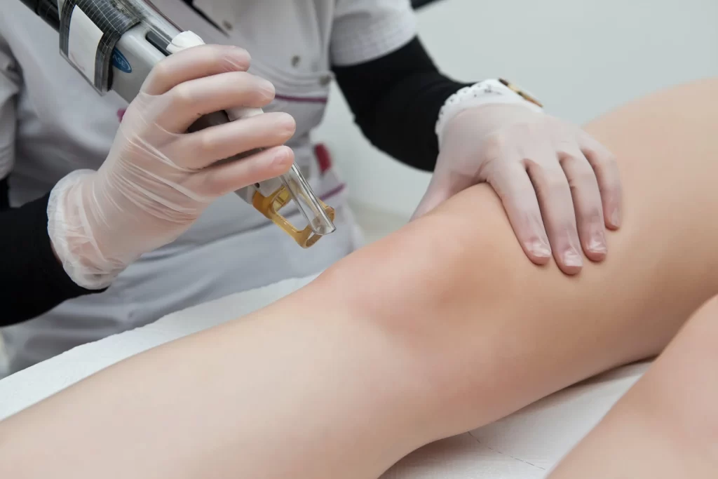 a lady is doing Laser hair removal at arnica clinic pune