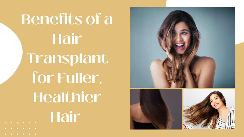 Discover the Benefits of a Hair Transplant for Fuller, Healthier Hair - Banner Images