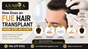 FUE Hair Transplant in Pune