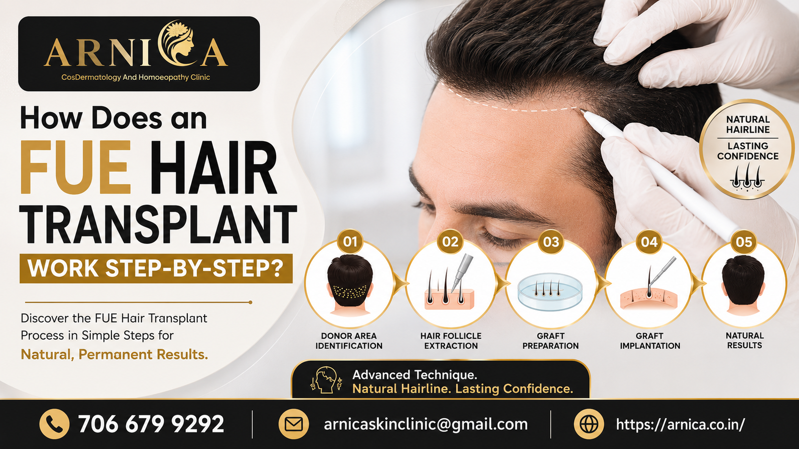 FUE Hair Transplant in Pune