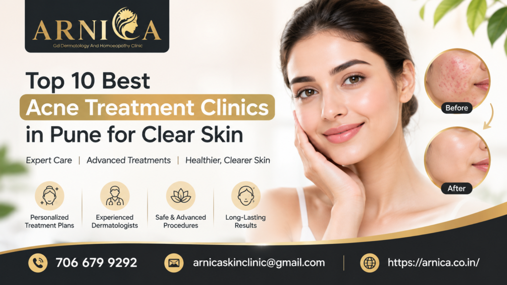 Acne Treatment Clinics in Pune