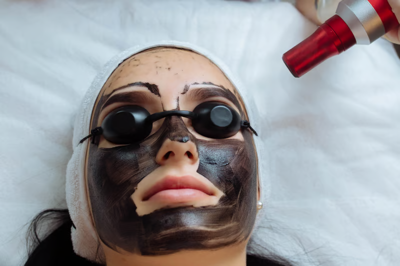 Affordable carbon laser peel in Pune