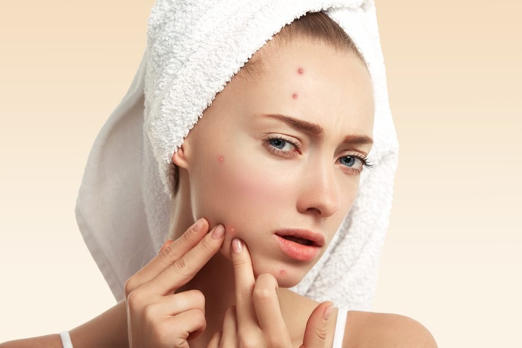 Acne scar treatment in Pune